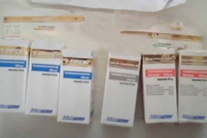 15.02.18 Βερσαλλίες Γαλλία